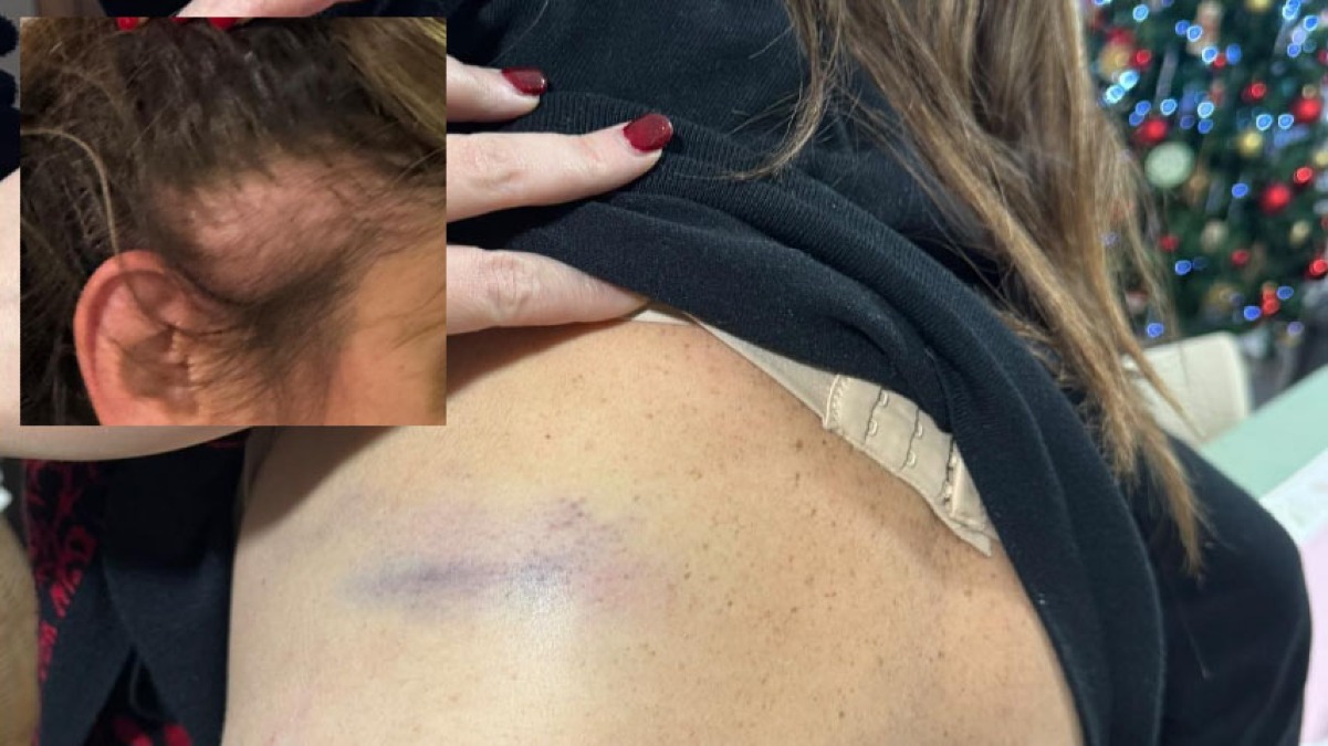 Massacrati da 7 persone per una banale lite condominiale - 