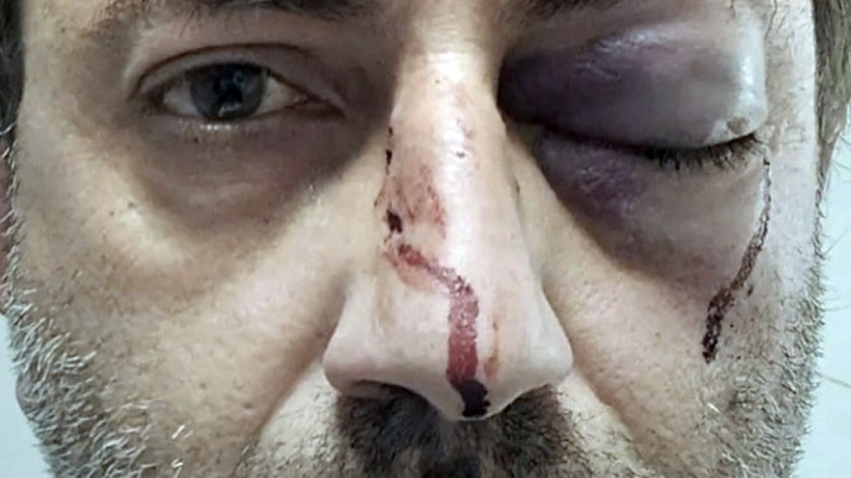 Medico preso a pugni a Capodanno - 