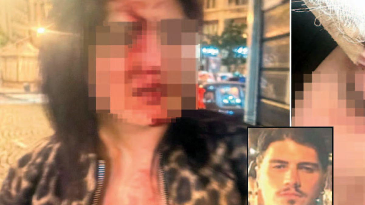 Esclusiva del "Roma": pestata a sangue da Pisacane - 