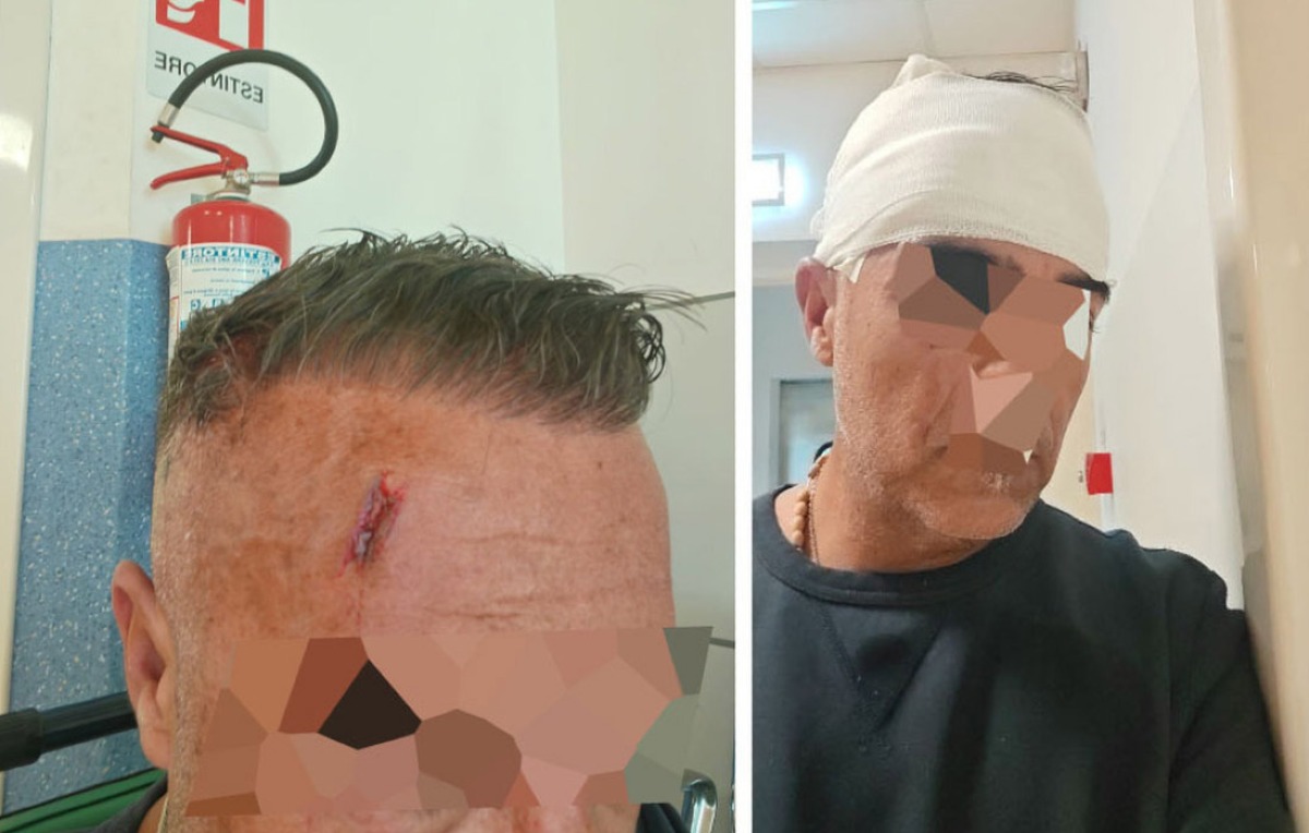 Non ha il biglietto e spacca la testa all'autista del bus - 