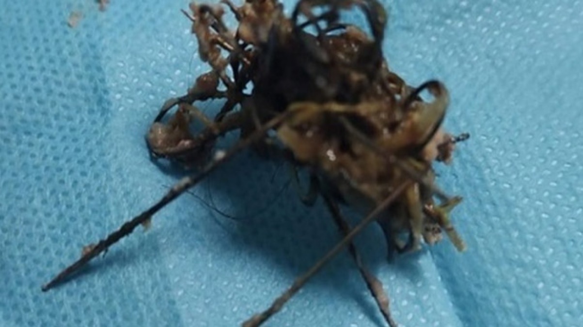 Wurstel pieni di chiodi a due pitbull: operati d'urgenza - 