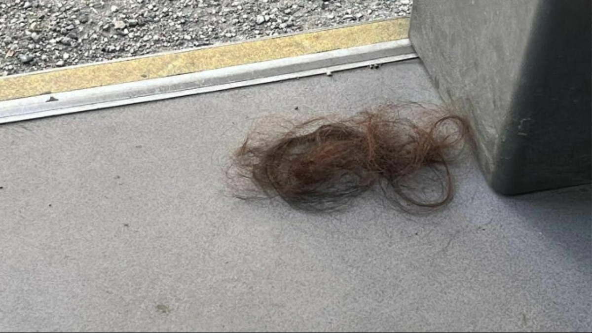 Autista aggredita sul lavoro, le strappano i capelli - 