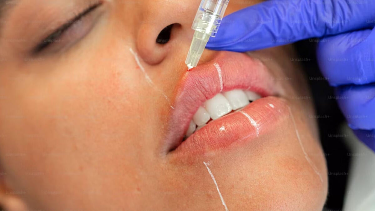 Assistente del chirurgo estetico lascia il lavoro e comincia a fare interventi senza titolo - 