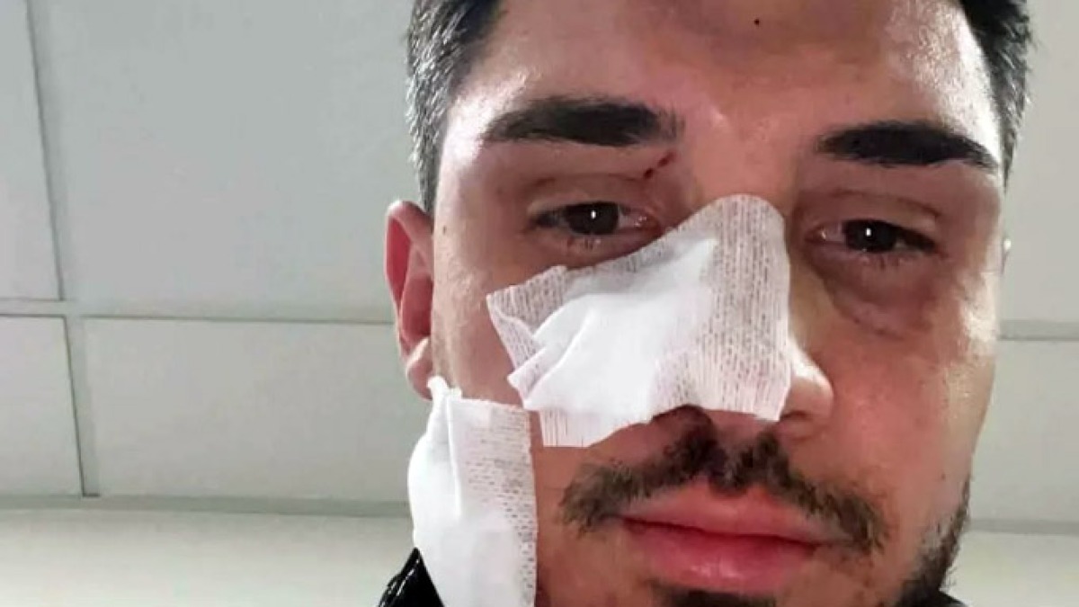 Riempito di botte per rapina sull'Asse Mediano - 
