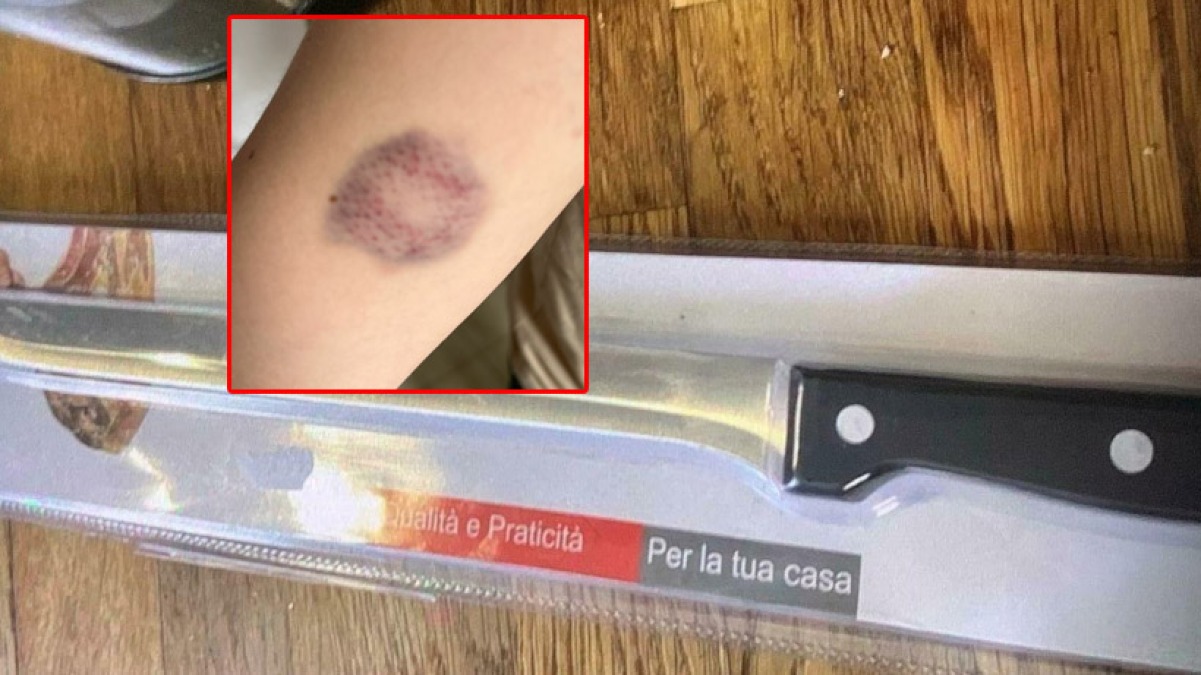 Porta coltello a scuola e aggredisce i compagni di classe - 