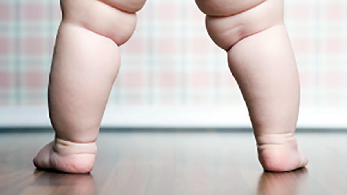 Progetto in 8 scuole contro l'obesità infantile, c'è anche San Giuseppe Vesuviano - 
