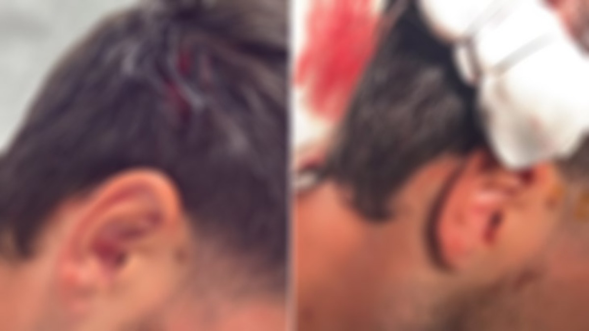 Sviene in via Toledo per un malore, ladro gli ruba gli occhiali mentre arrivano i soccorsi - 