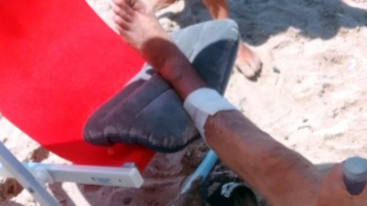 Due bagnanti morsi a sangue dai pesci in Cilento - 