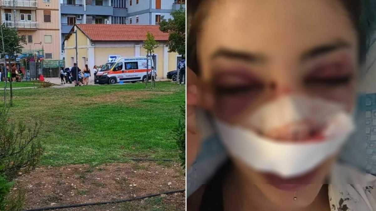 Picchiata senza motivo dal branco al parco: studentessa ferita al volto - 