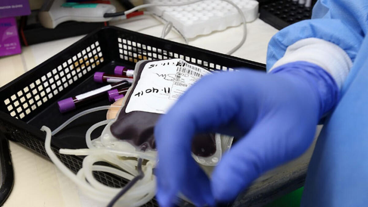 Virus West Nile nella sacca del sangue donato - 